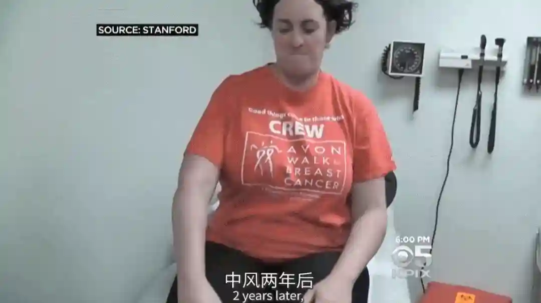 干细胞应用仅一天，她的手臂竟抬起来了