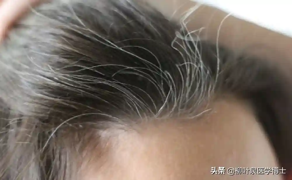 白发，能否让它来得晚一些？