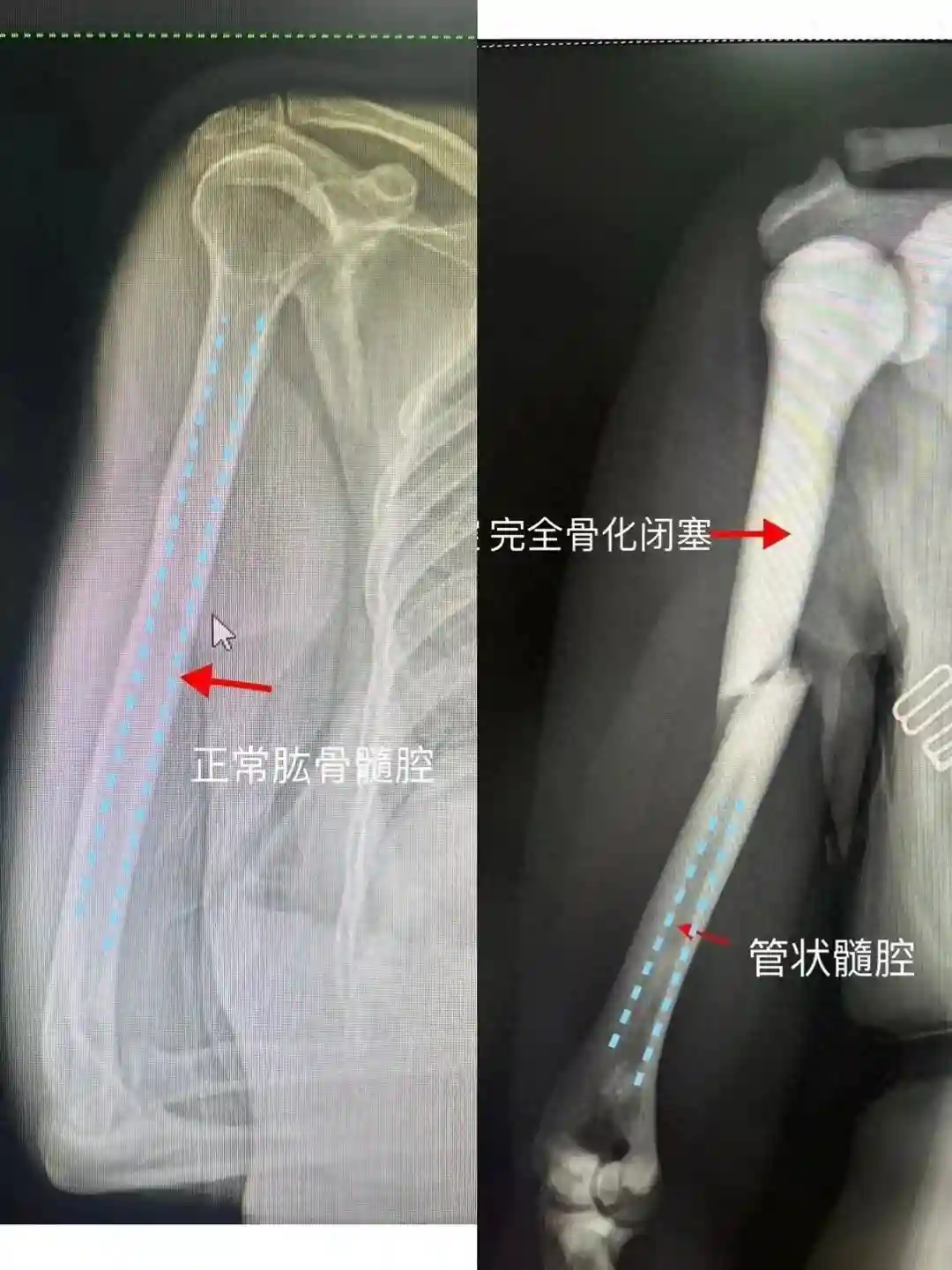 超罕见！宁波发现一例