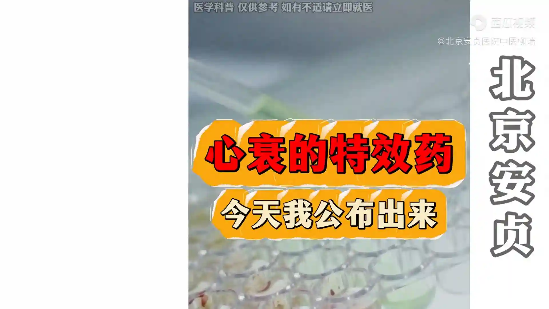 北京安贞医院柳瑞：心衰的药，今天我来说一说