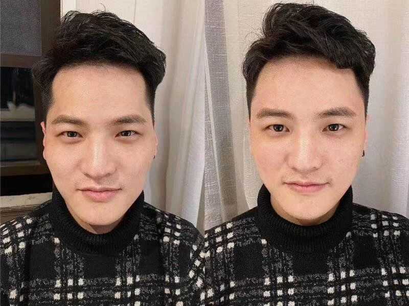 邱录贵教授：多发性骨髓瘤转化医学研究15年进展报告