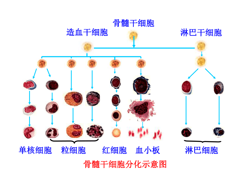 ACS Nano | 类中性粒细胞膜包被纳米酶治疗缺血性脑损伤