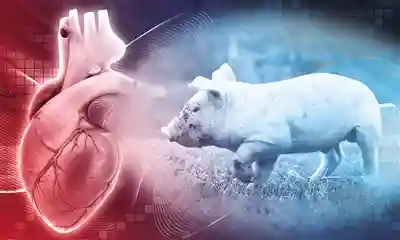 全球首例异种移植取得突破