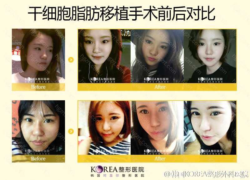 细胞外基质增强人脐带干细胞的抗氧化能力