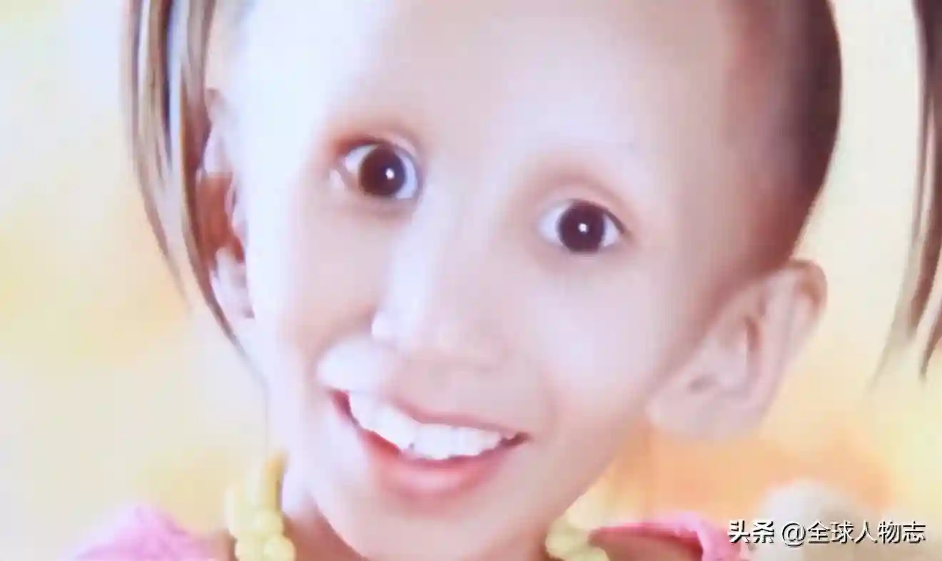 19年前，那个4岁就衰老的女孩桐桐，被断言活不20岁，今还在人世