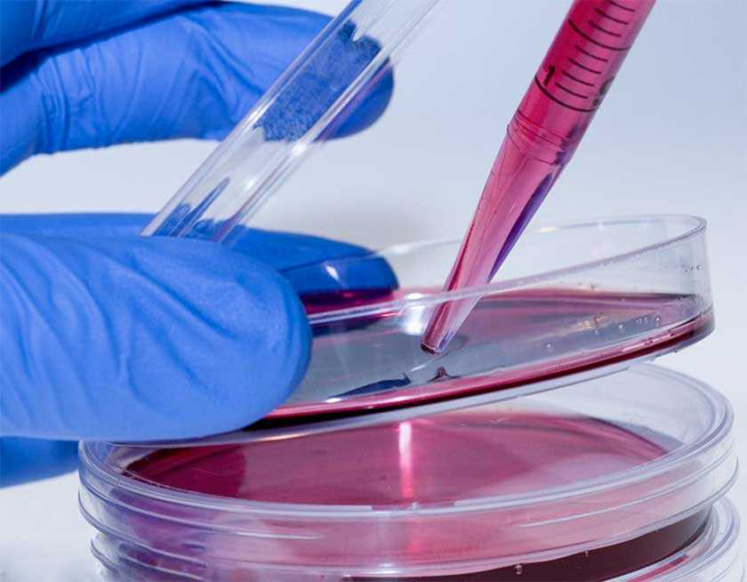 大脑衰老是否可逆？或取决于生长环境够不够软