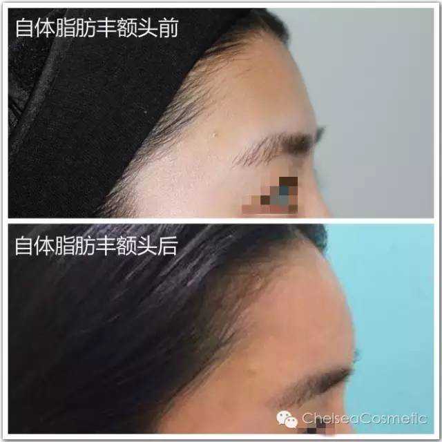 试管婴儿先行者逝世