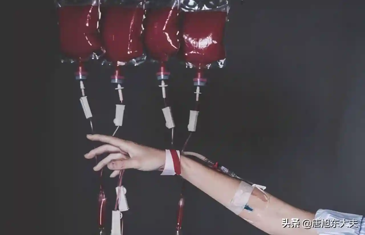 再生障碍性贫血长期输血，能保持正常寿命吗？