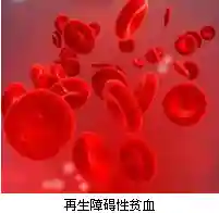 中医药补肾生血法治慢性再障性贫血