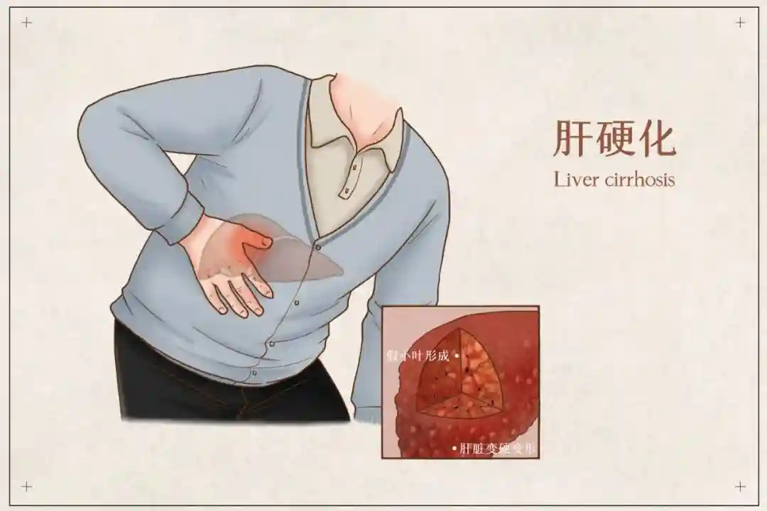 一分钟了解干细胞如何改善肝硬化